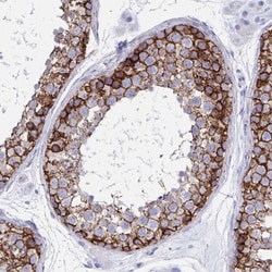 N-Cadherin Antibody, Novus Biologicals 25 &mu;L, Unlabeled:Antibodies,